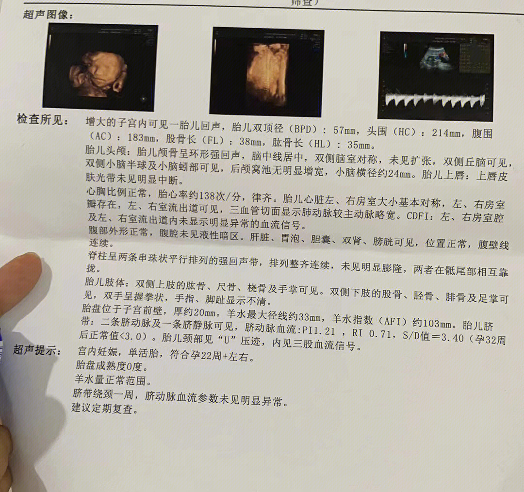 从怀孕那一刻的起,我跟你谈了9个多月的恋爱,你在肚子里慢慢长大,学会