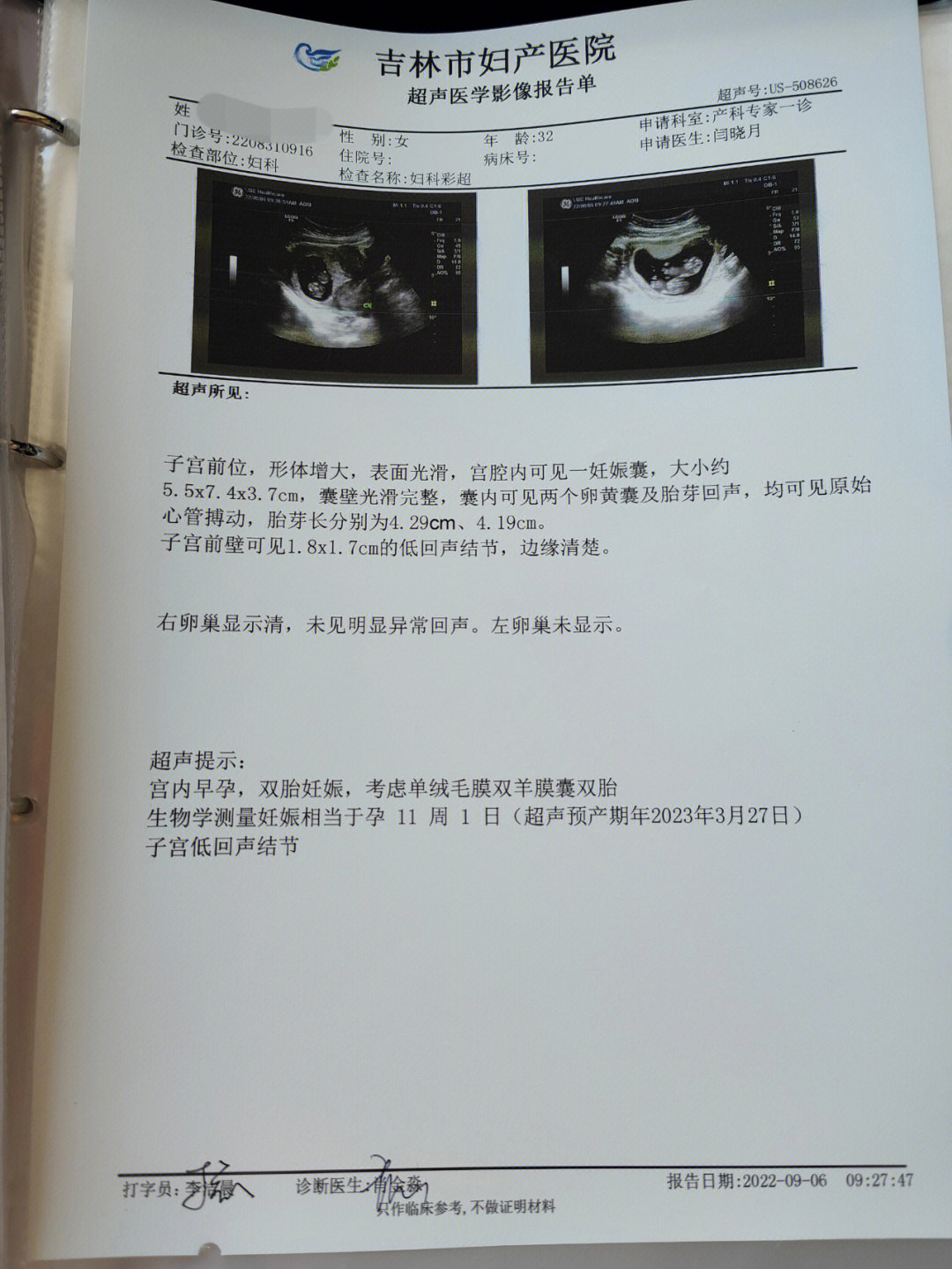 未怀孕的彩超图图片