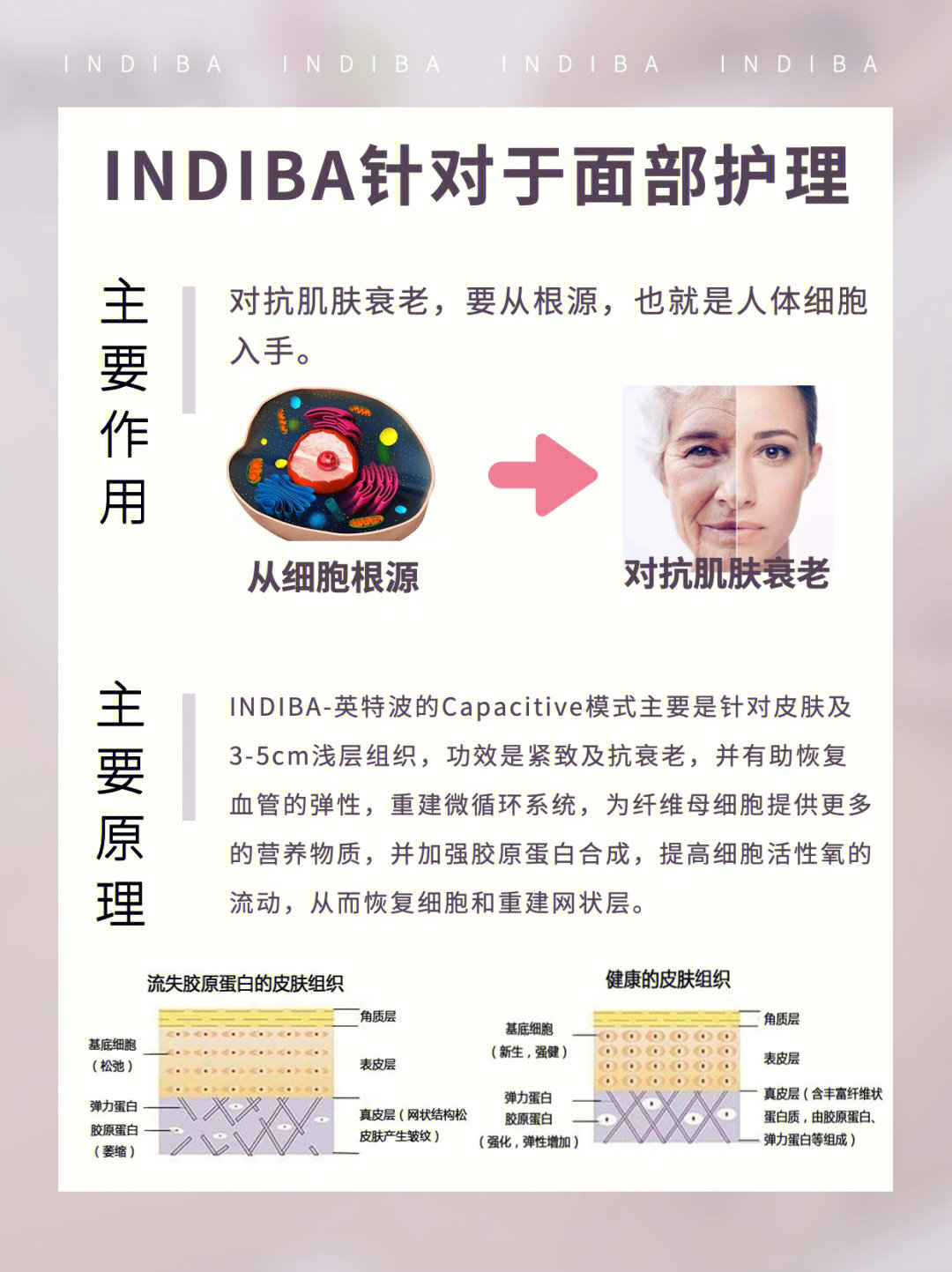 73主要原理:indiba-英特波的capacitive模式主要是针对皮肤及3-5cm