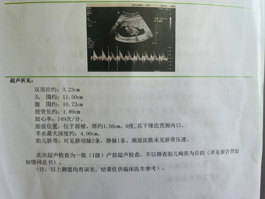 怀孕十六周图片