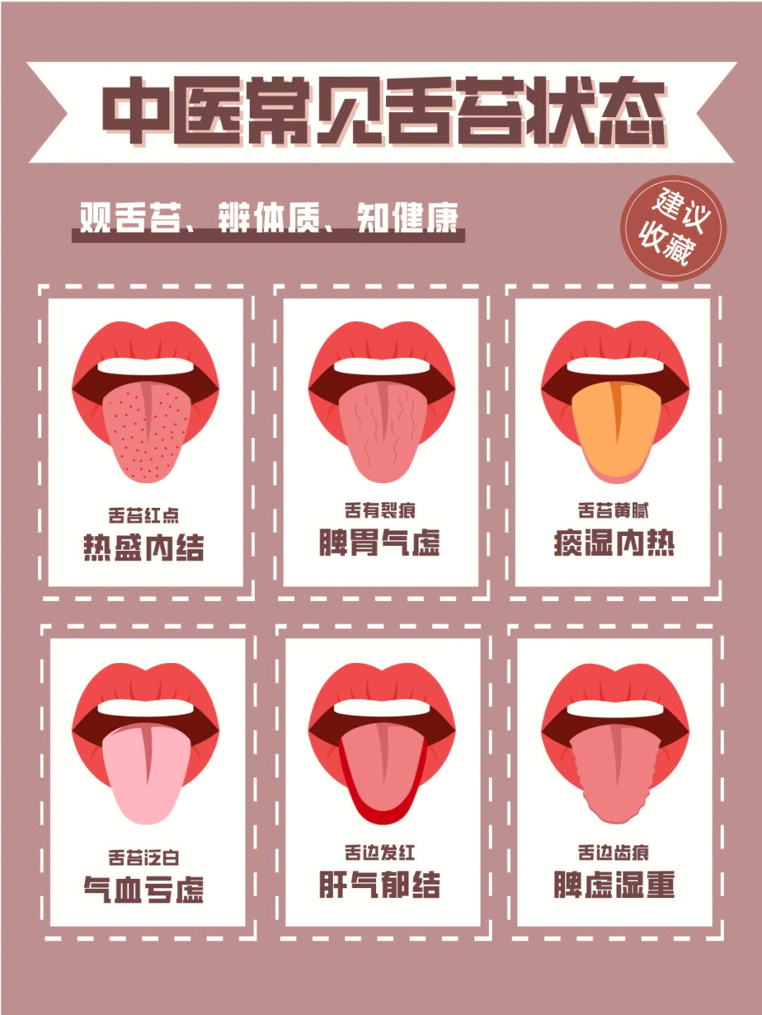 中医常见舌象调理指南78从舌苔判断身体健康