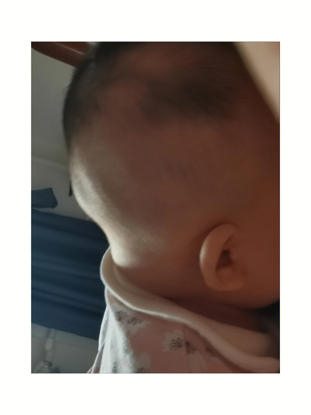 宝宝缺钙前额突出图片图片