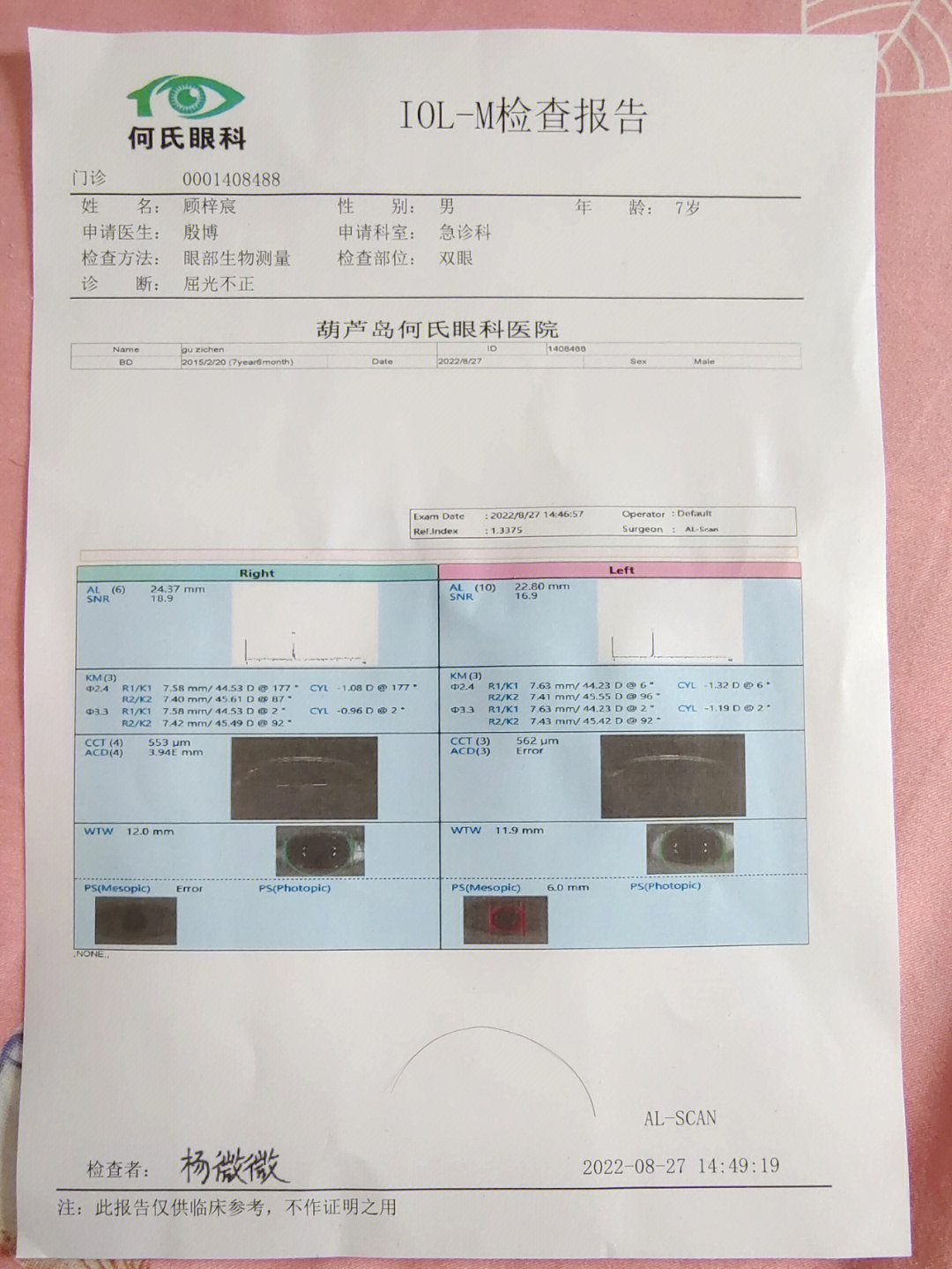 7周半单眼近视375度另一只正常适合ok镜吗