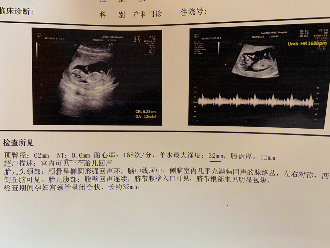 孕12周胎儿大小标准图片
