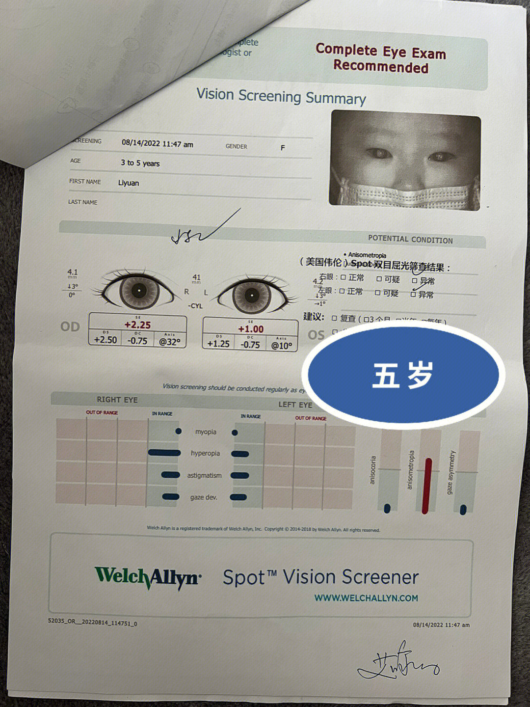 儿童视力筛查结果可以有多离谱?