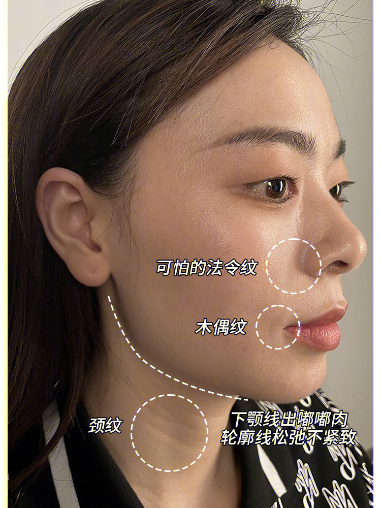 各种纹纹路路下颚线肉嘟嘟轮廓松弛不紧致