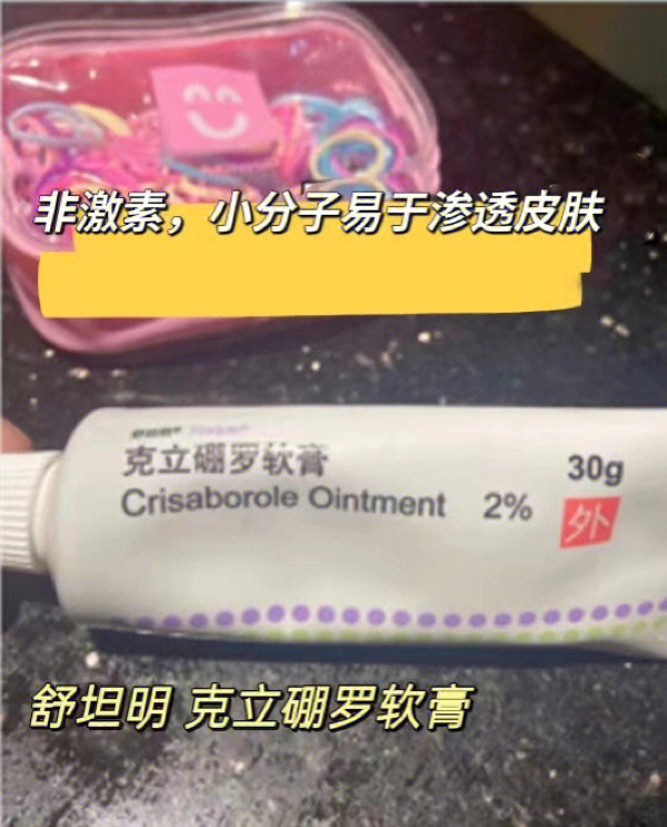 克立硼罗软膏治银屑病图片