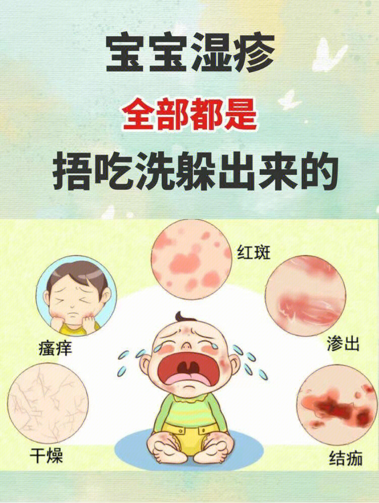 宝宝湿疹是怎么引起的图片