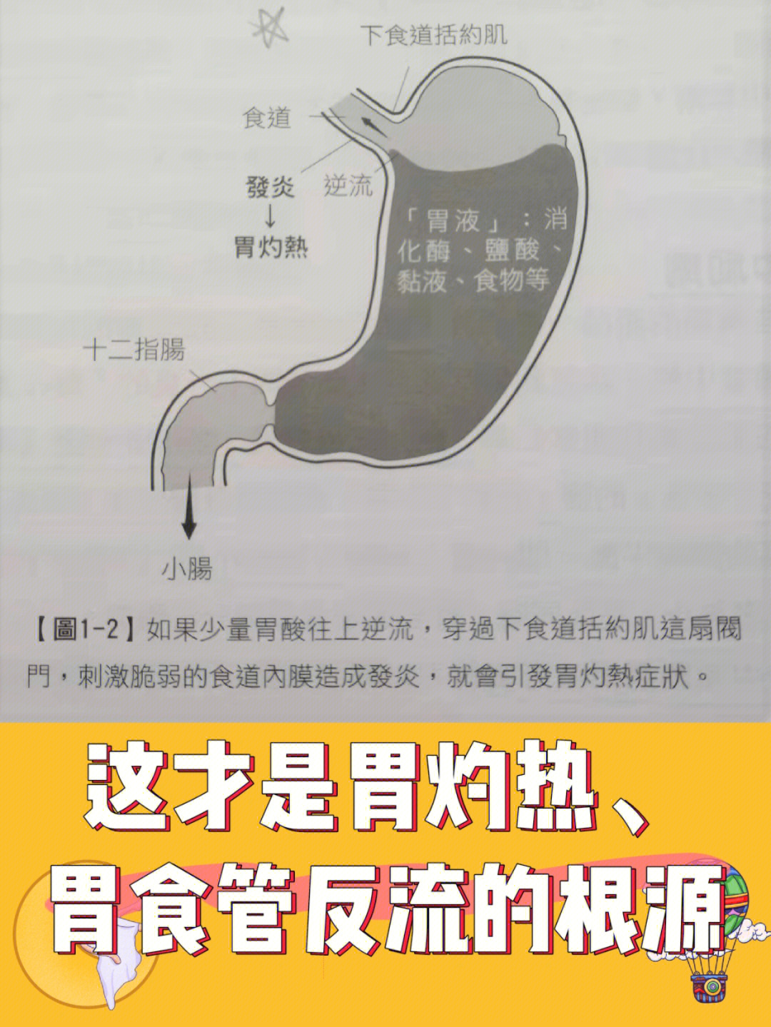 胃酸是怎么回事图片