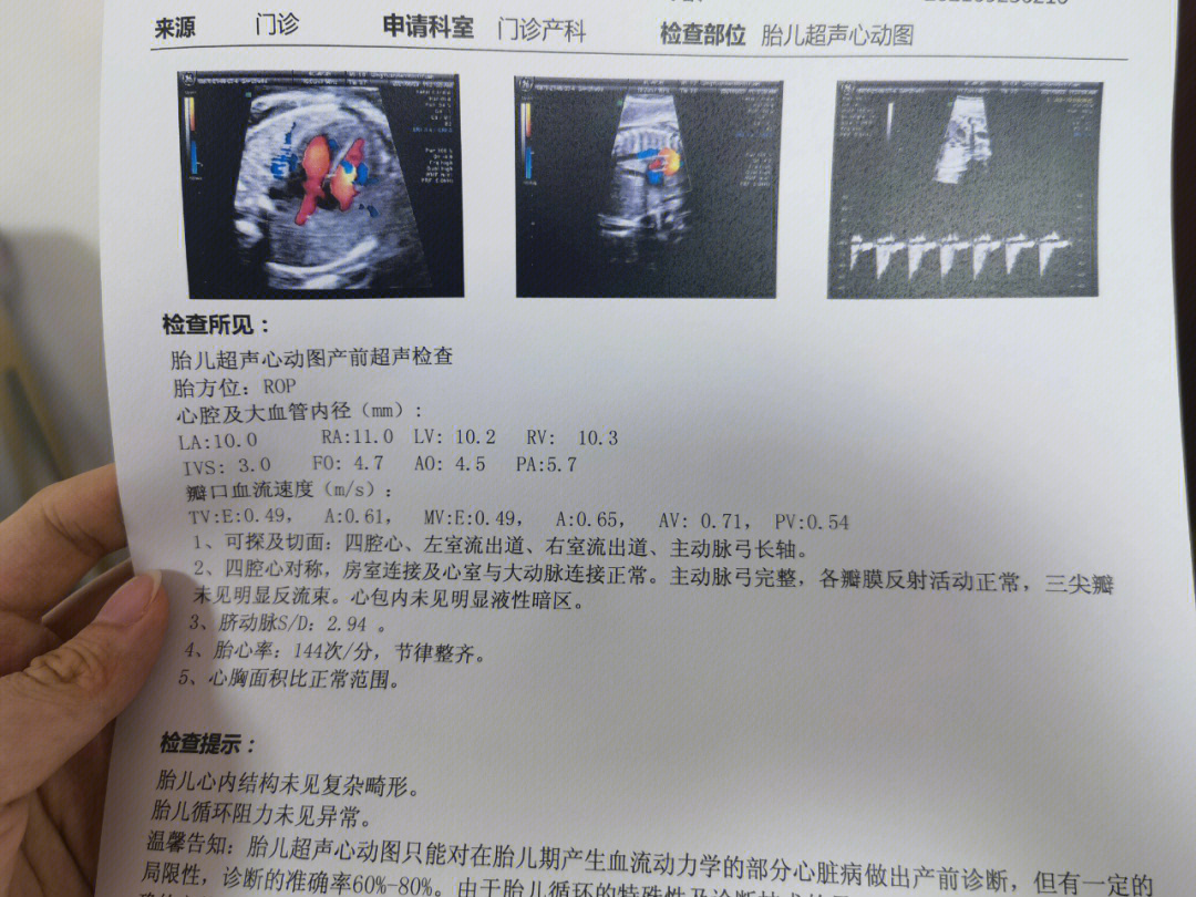 28周做胎儿超声心动图图片