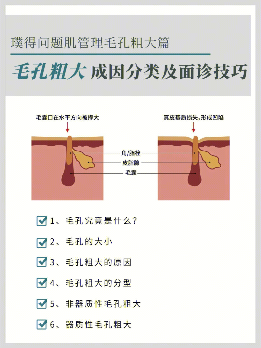 各种类型毛孔说明图图片