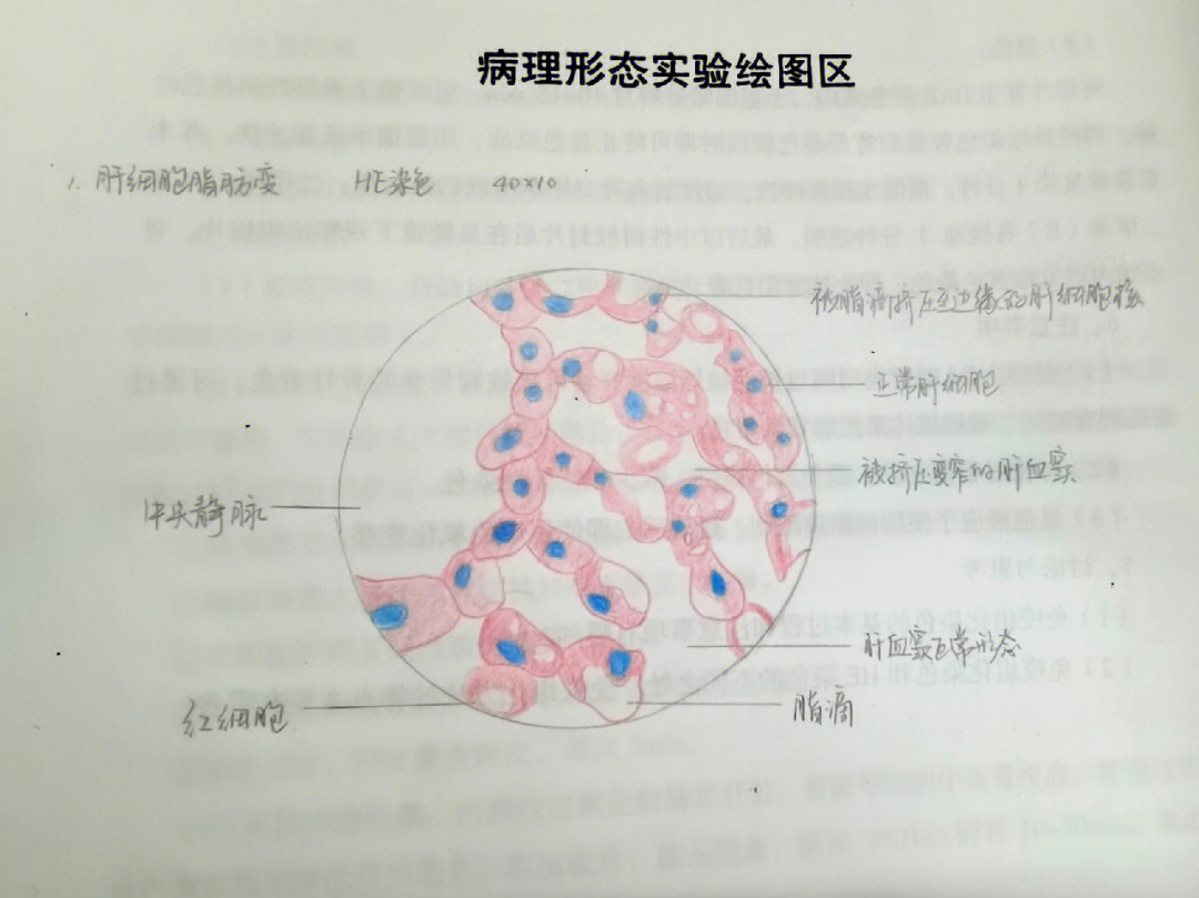 淀粉粒的三种形态绘图图片