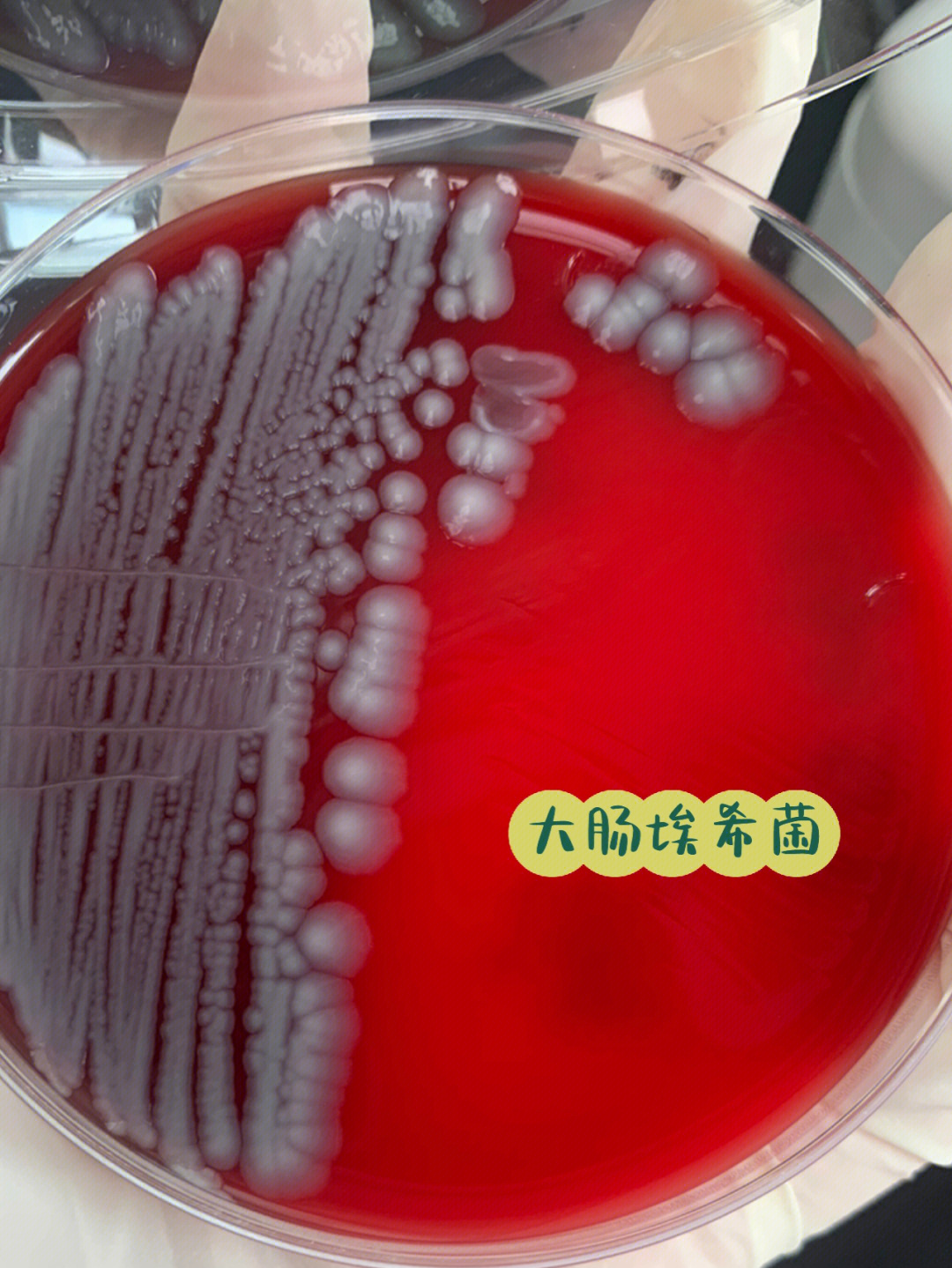 大肠埃希菌镜下形态图片