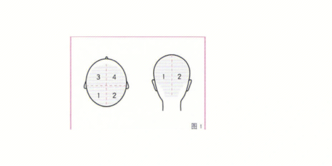 首先就是把头发进行分区处理没染过头发的可以参考图2,染过参考图4