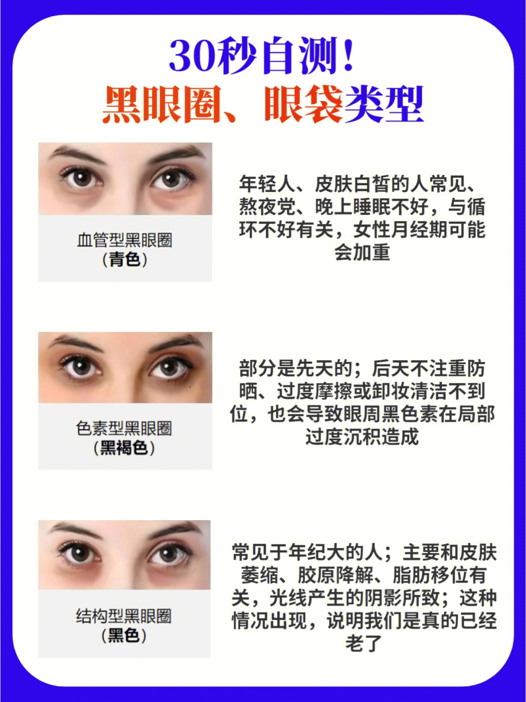 眼睛类型自测图图片