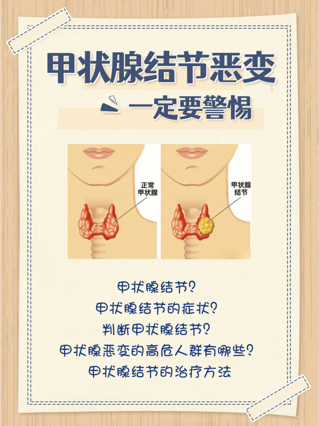 甲状腺结节自查图图片