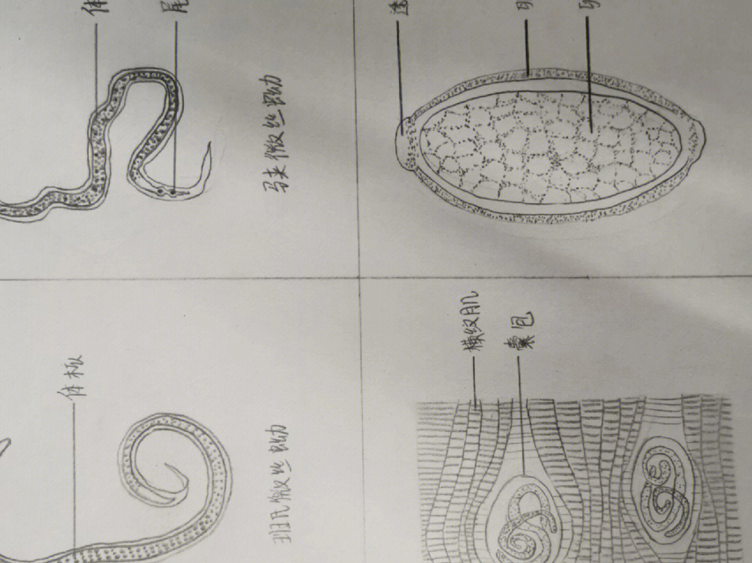 旋毛虫微丝蚴手绘图图片