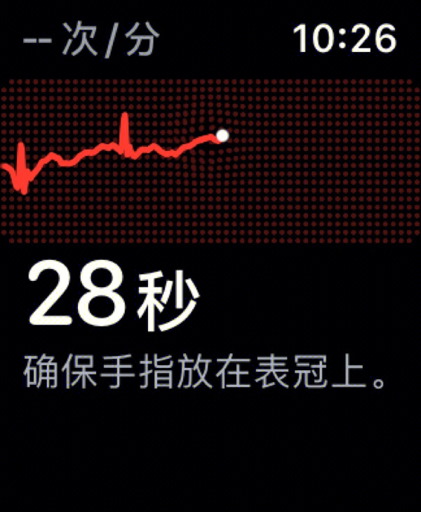 applewatch心电图