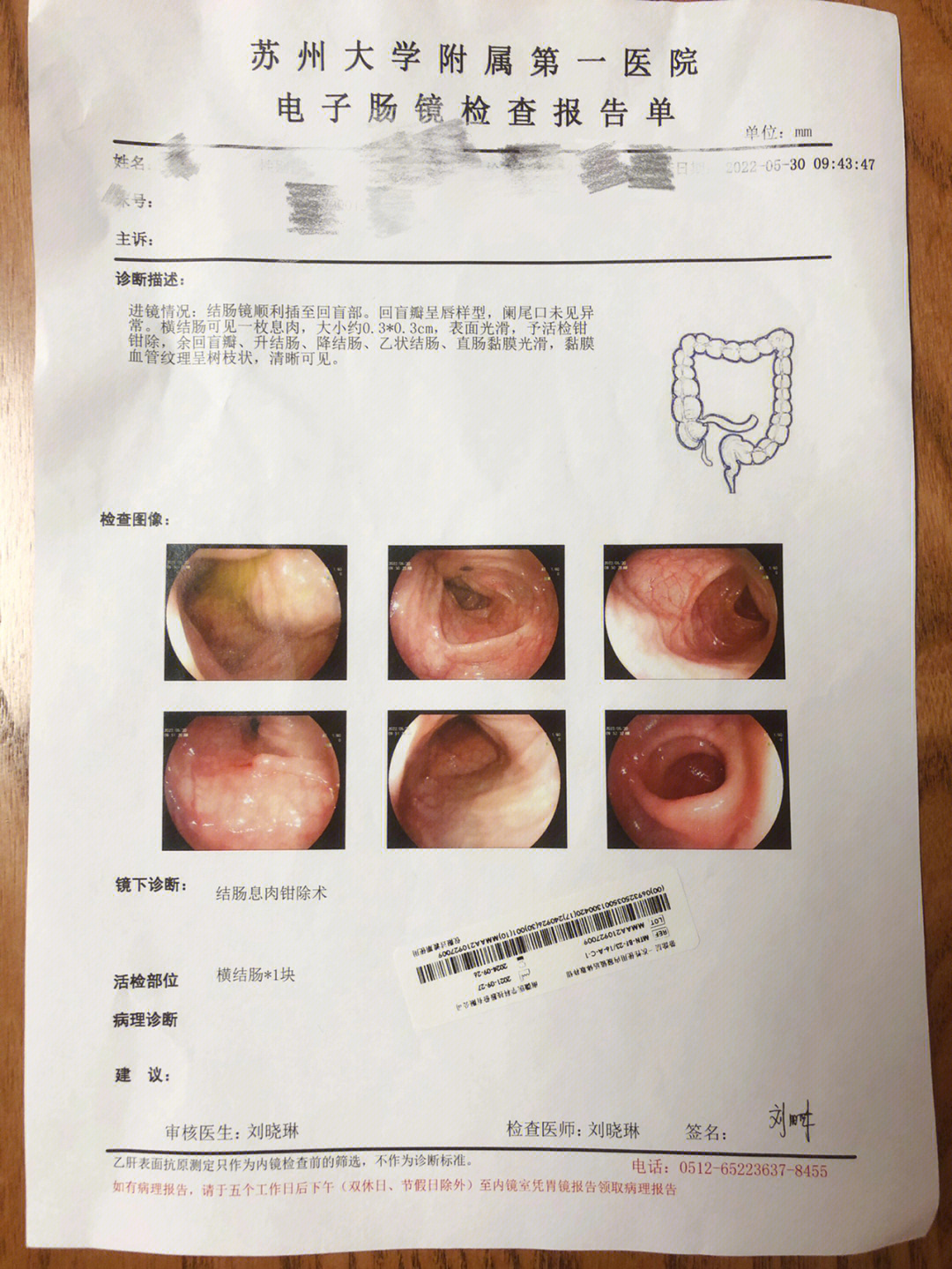 十二指肠溃疡怎么检查图片