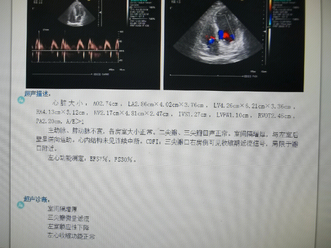 继续更新超声系列