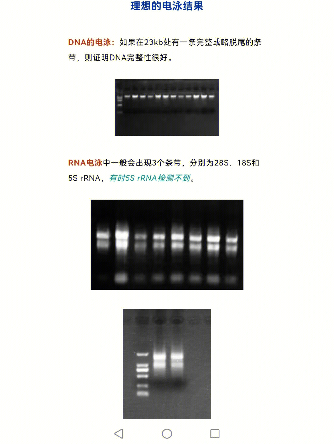 实验室操作之核酸电泳不合格结果分析