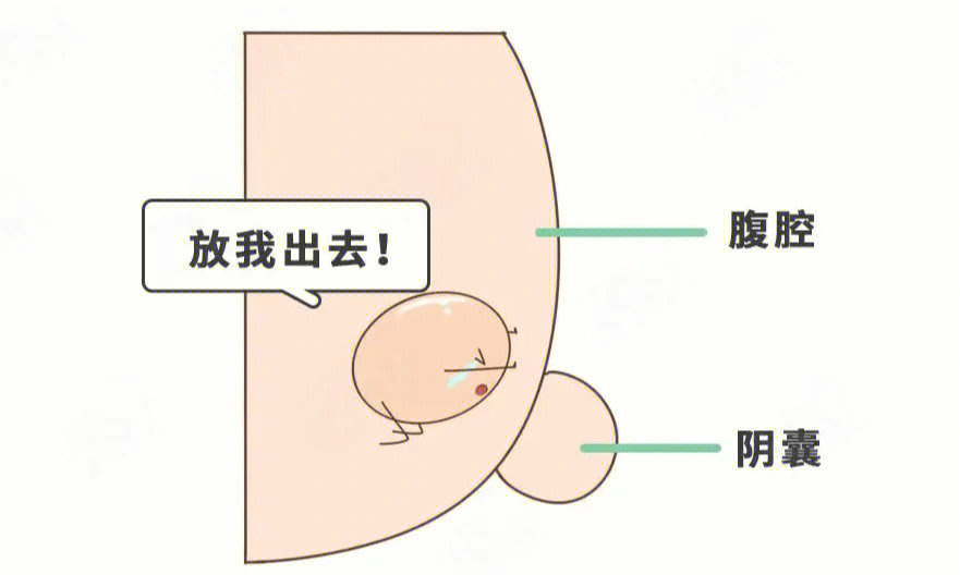 怎么判断宝宝隐睾图片