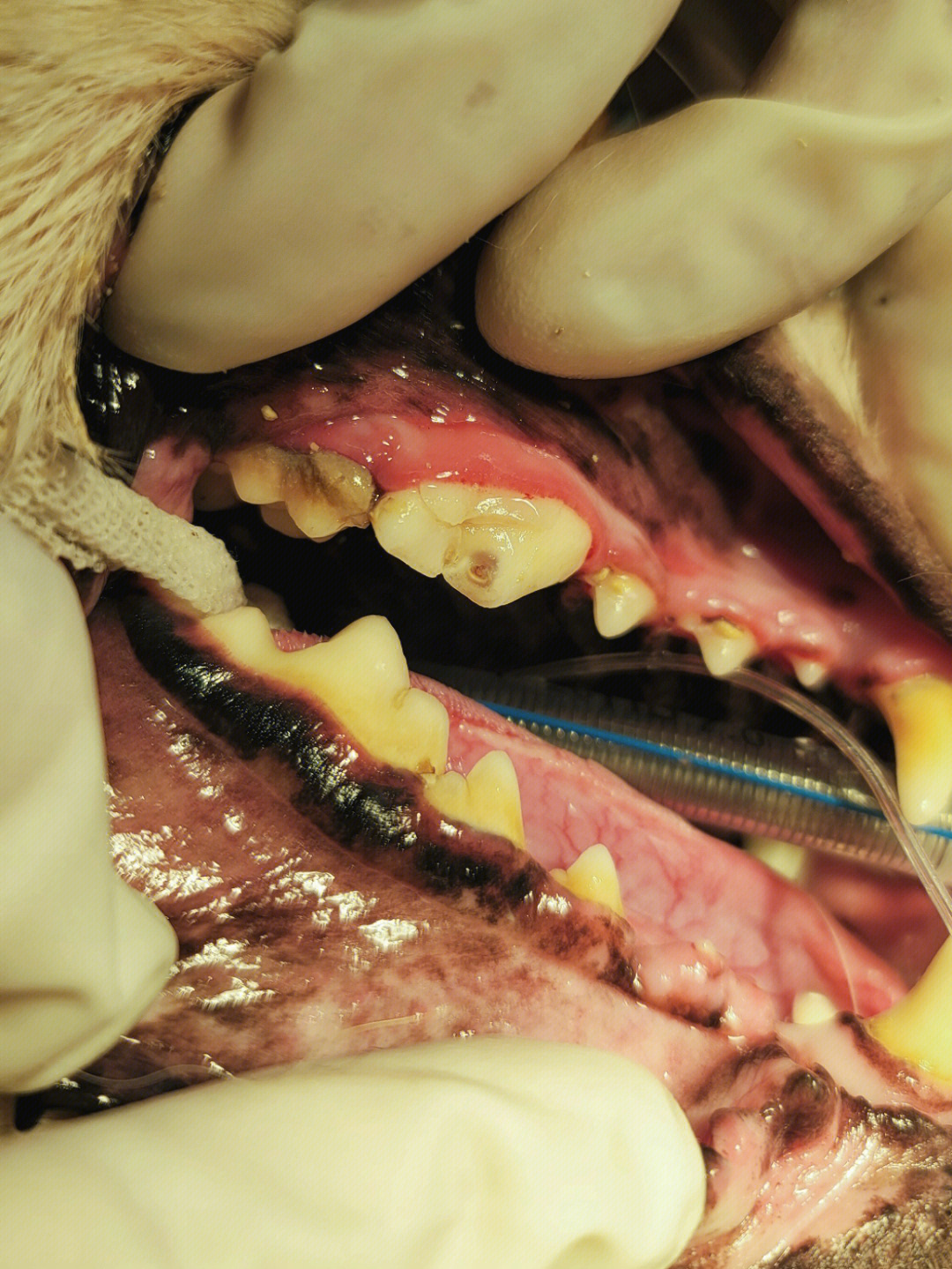 牙息肉怎么治疗图片