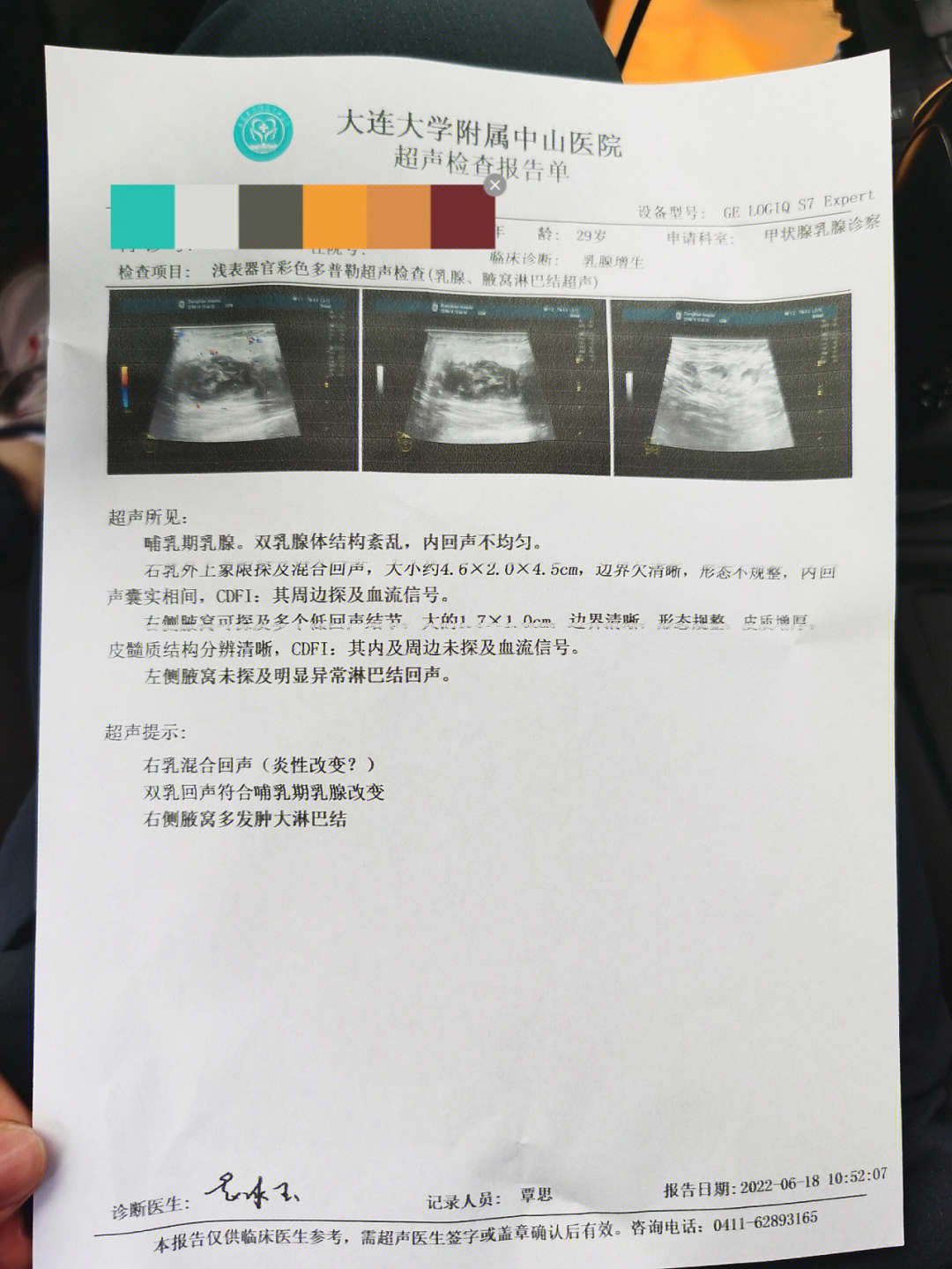 化脓性乳腺炎超声图片图片