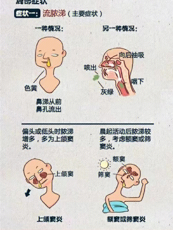 鼻窦炎头痛位置图解图片