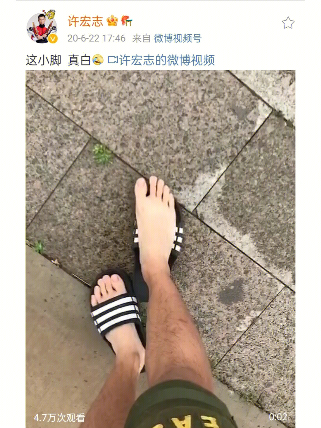 许子这腿真的是你的吗