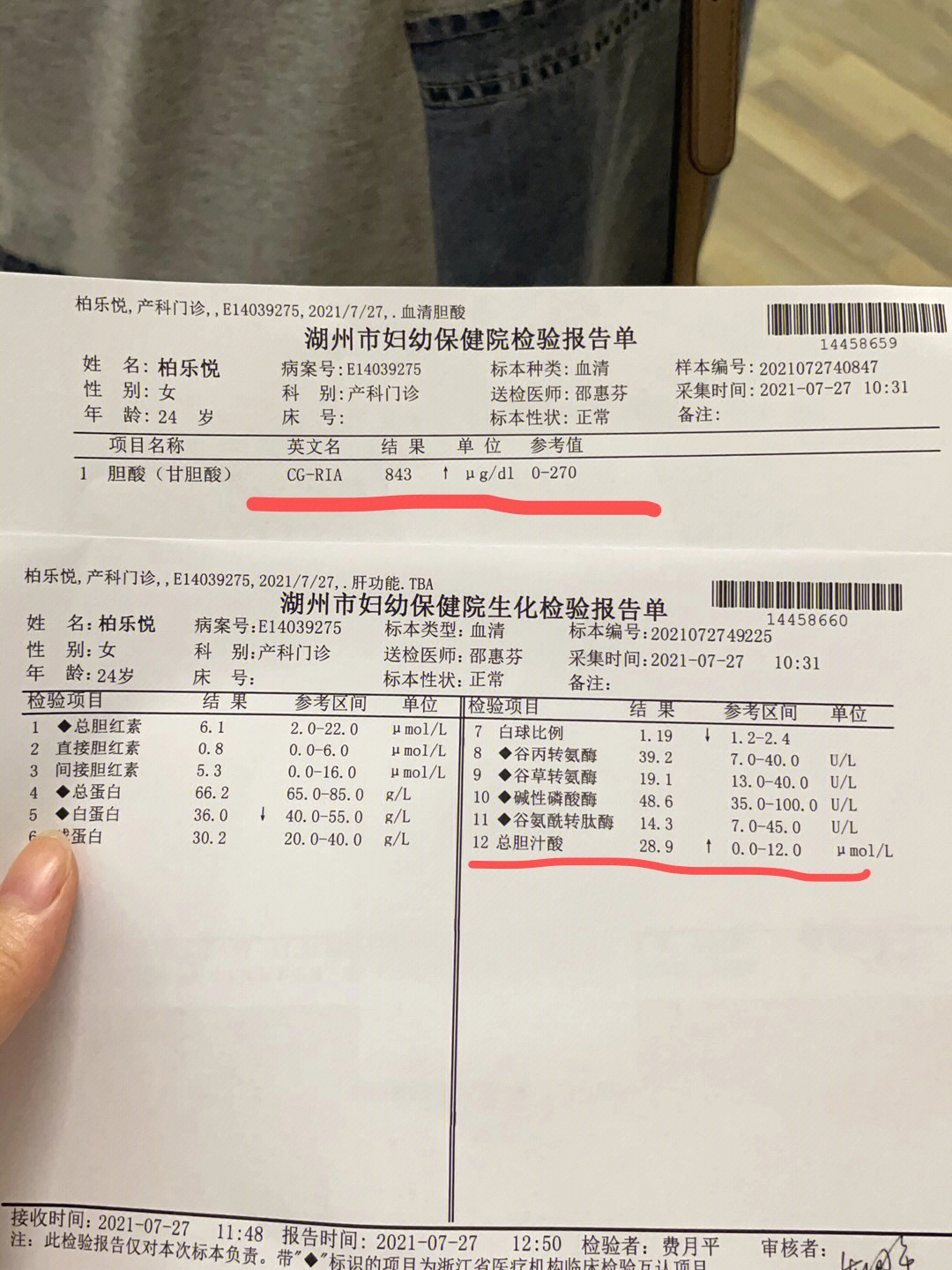 孕妇胆汁淤积图片