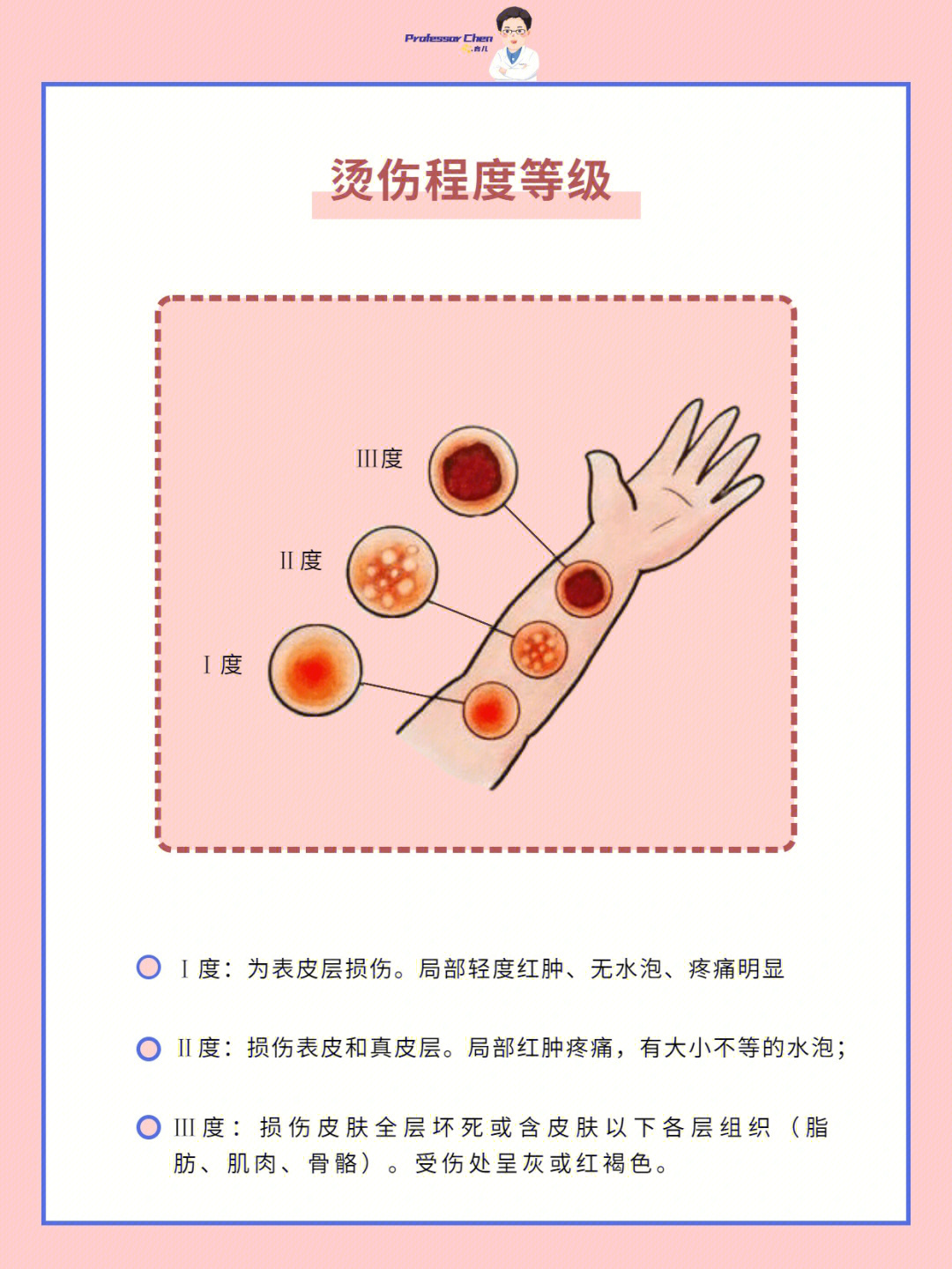 冬天容易被烫伤正确的处理措施很重要