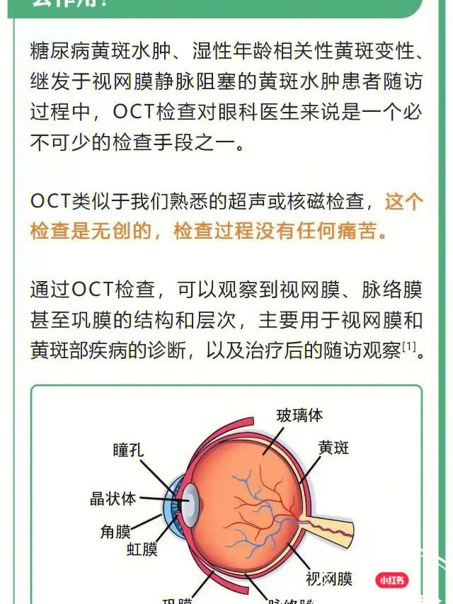 oct检查有什么作用