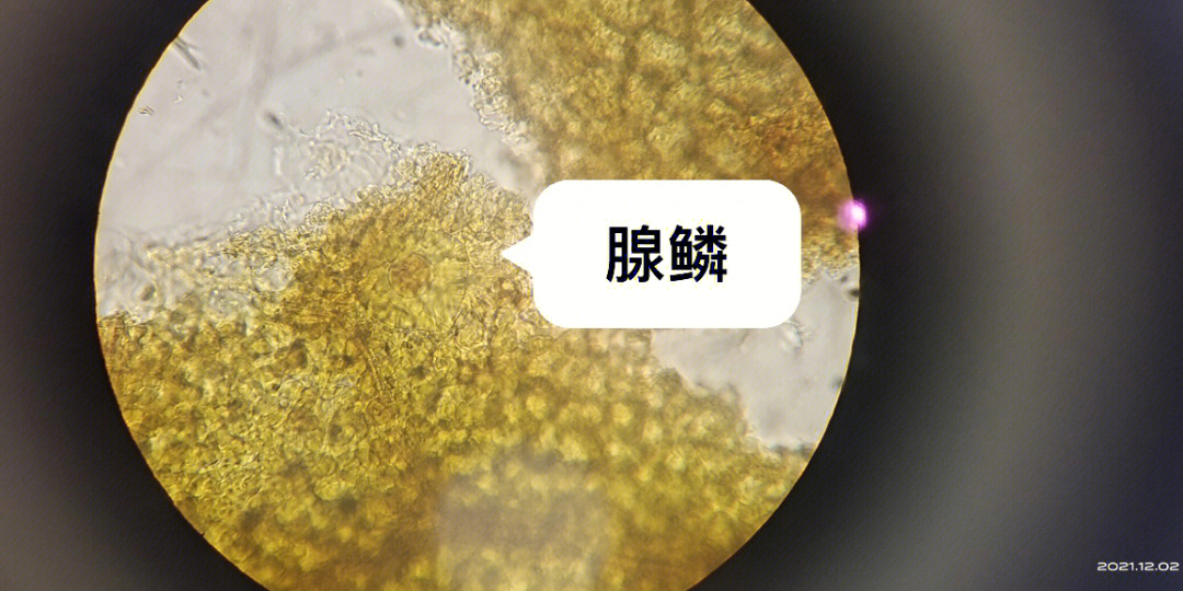 薄荷叶腺毛的显微图图片