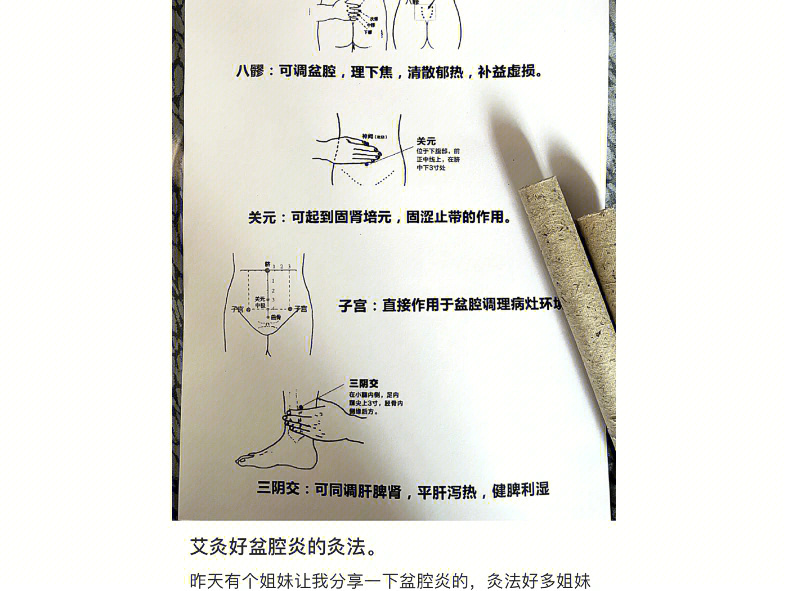 慢性盆腔炎    开始我的盆腔炎治疗之行,希望我能战胜它