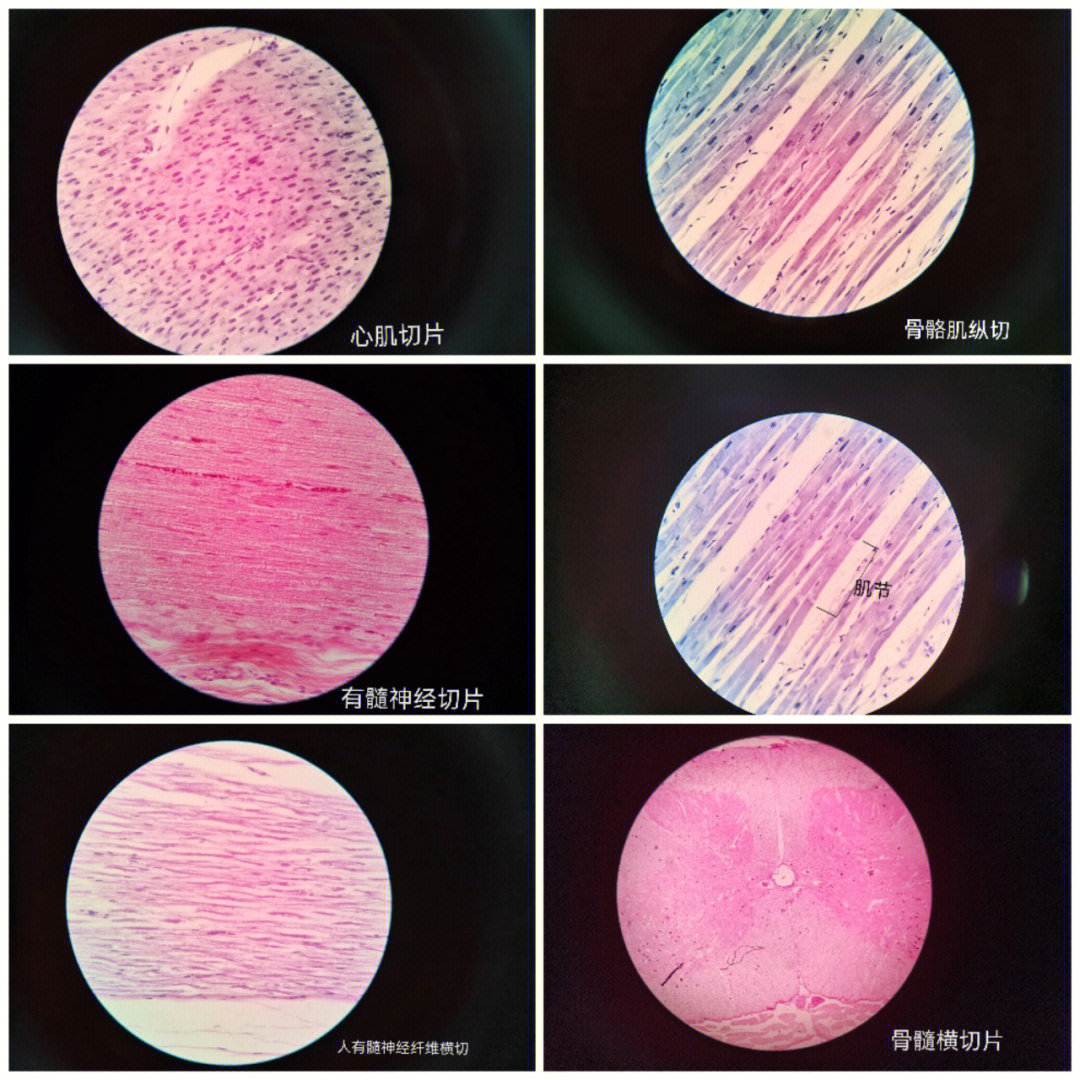 肌肉组织显微镜观察图图片