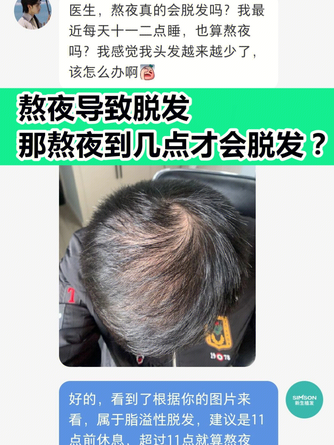 熬夜到几点才会脱发?专家告诉你答案