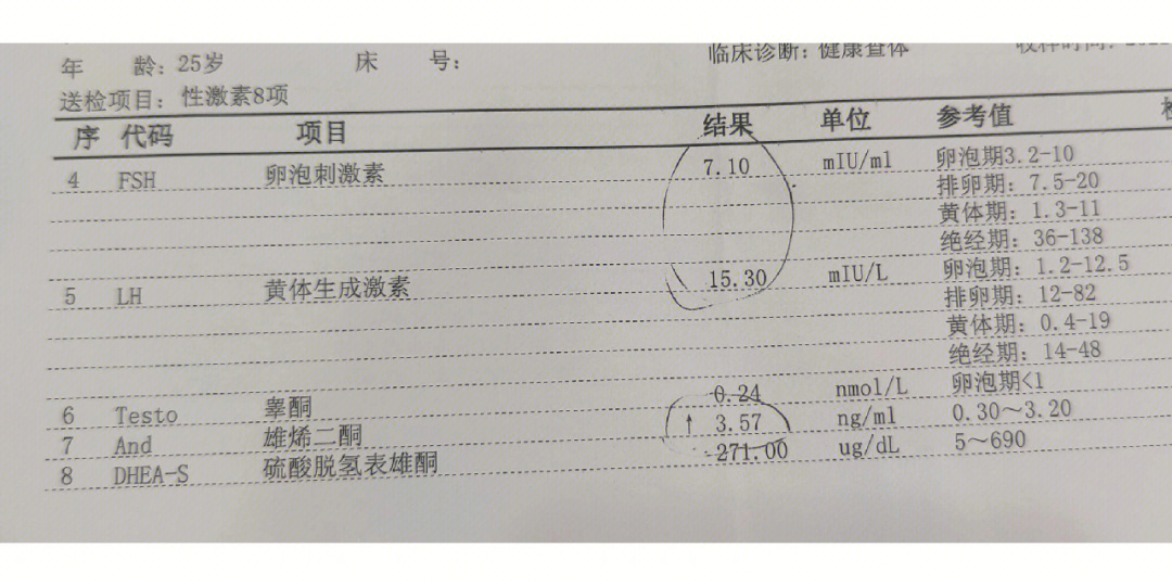 多囊卵巢综合症化验单图片