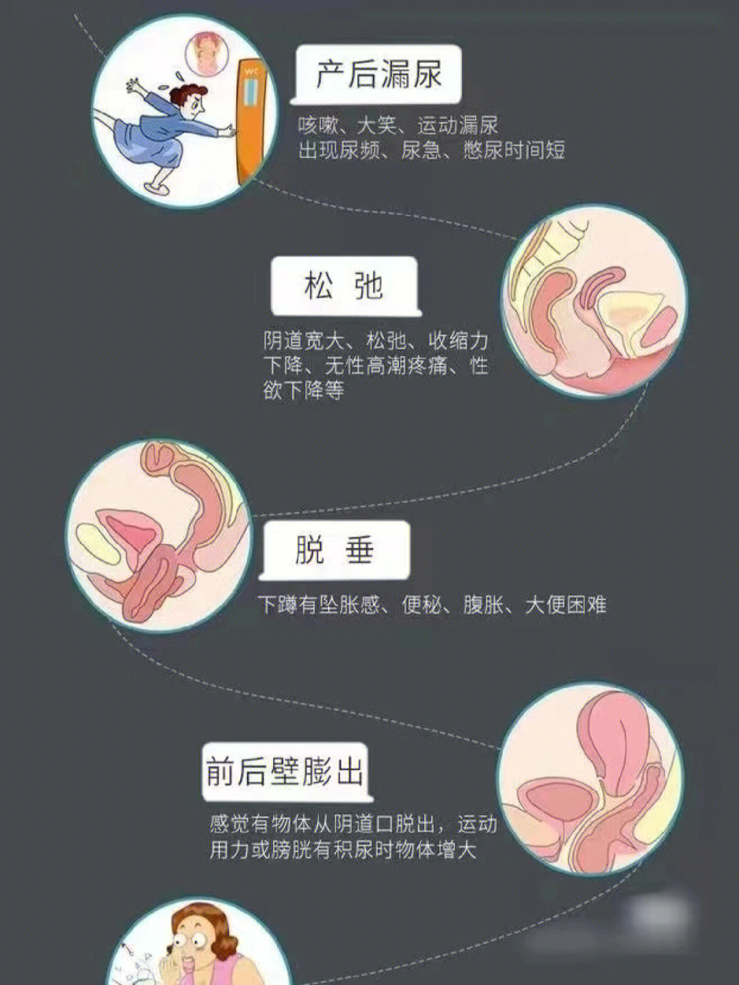 腹直肌分离危害