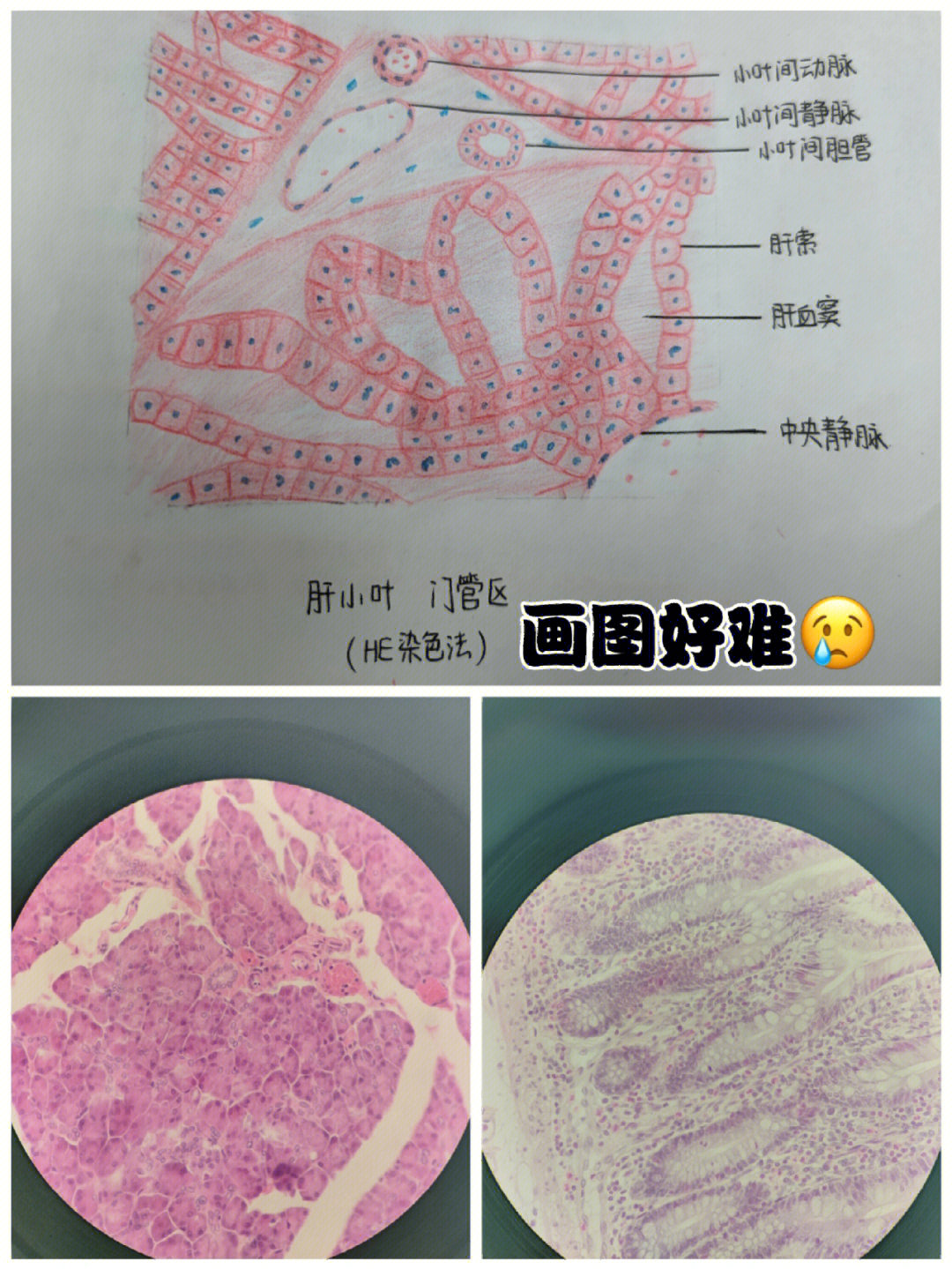 小叶间动脉图片