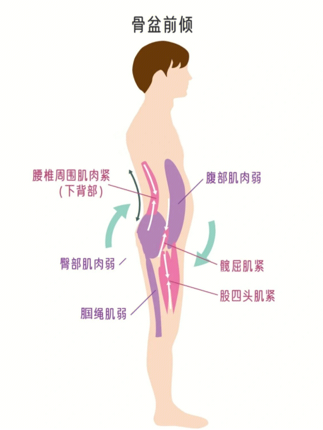 小腹突出,即使吸气后仍有突出,这时通过测量来评估自己是否有骨盆前倾