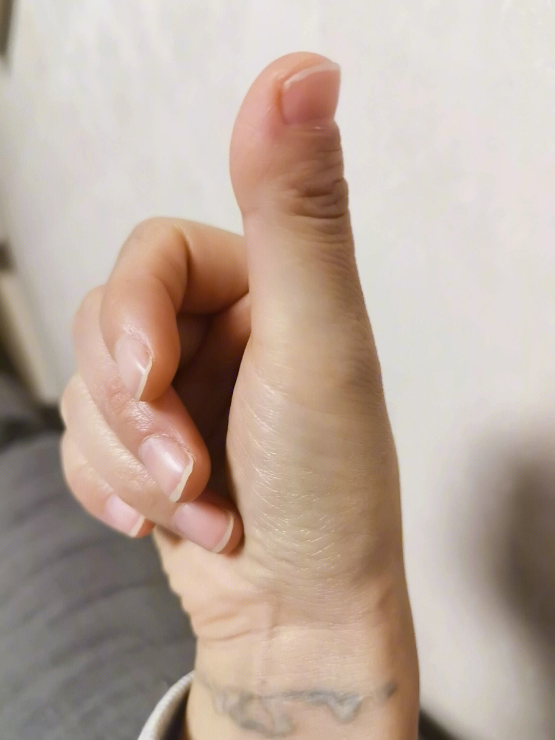 大拇指短宽的女人图片