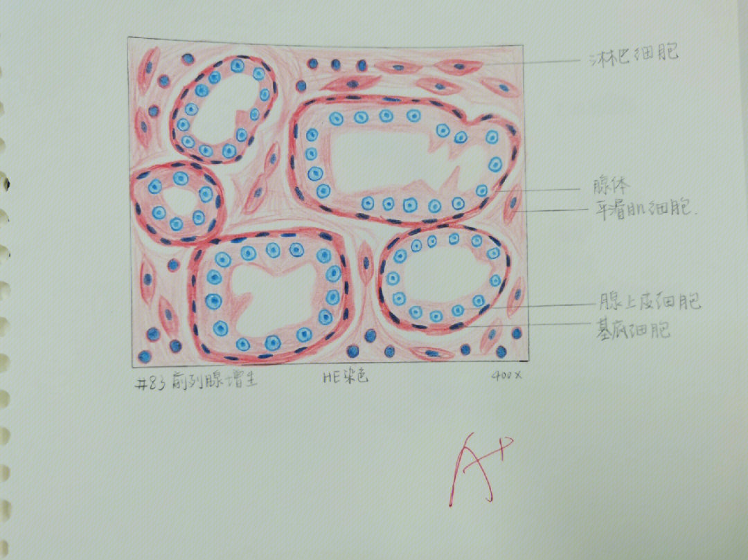 病理红蓝铅笔绘图4完