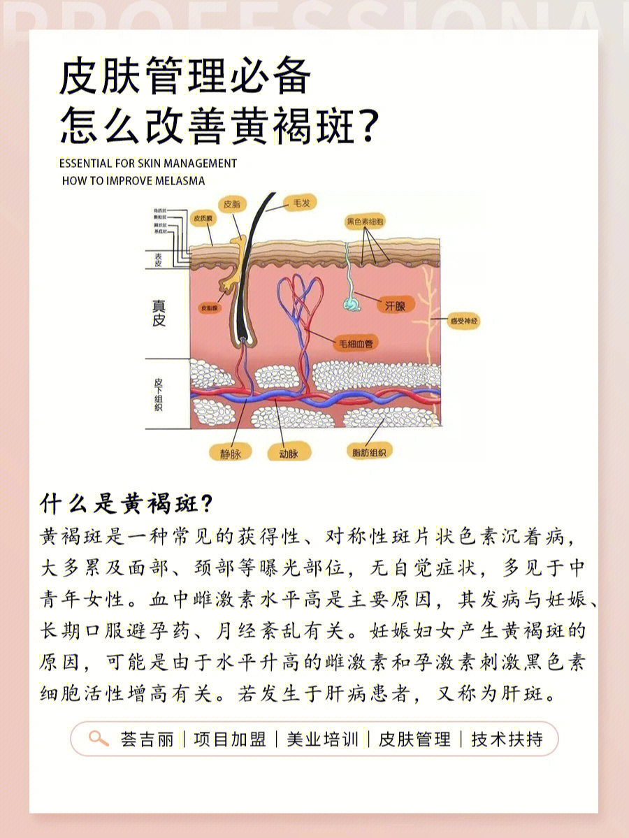 咖啡斑是怎么引起的图片