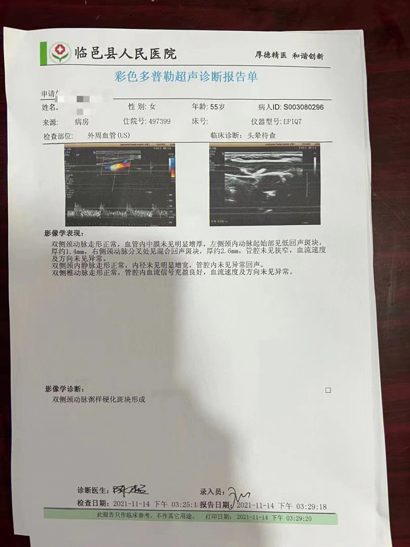 颈动脉斑块超声图片