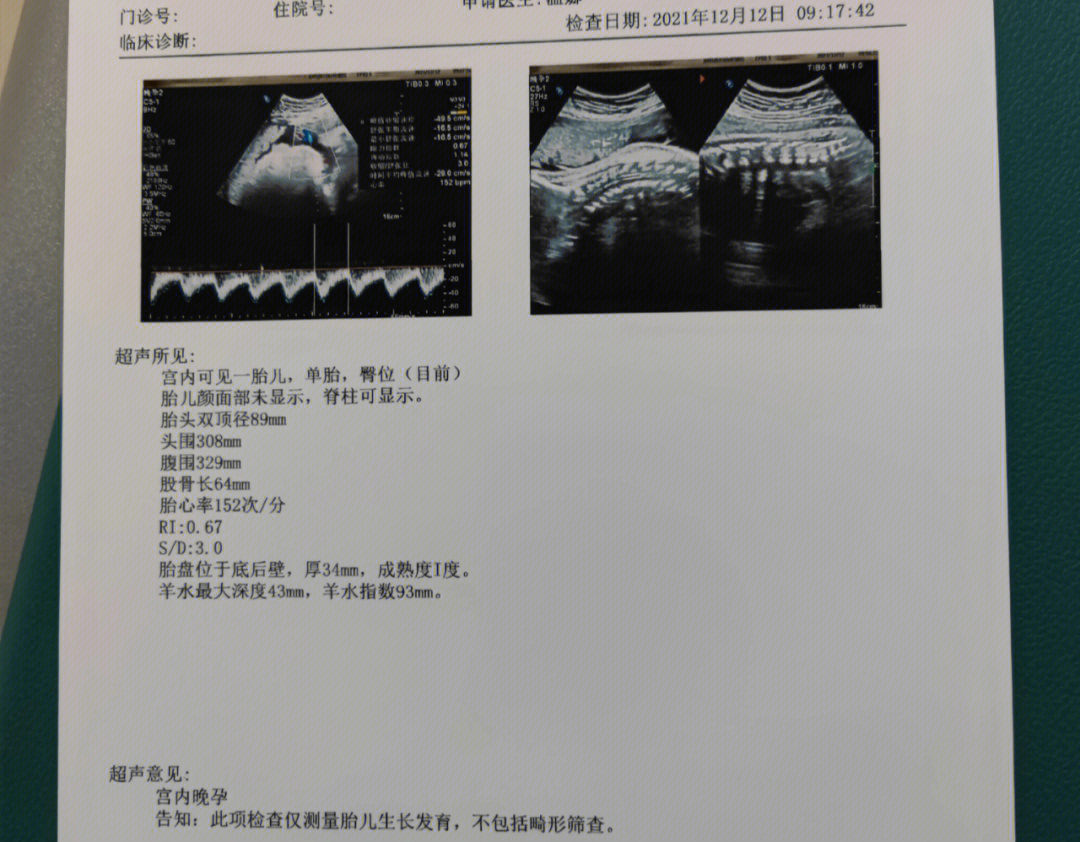 怀孕37周胎儿彩超图片