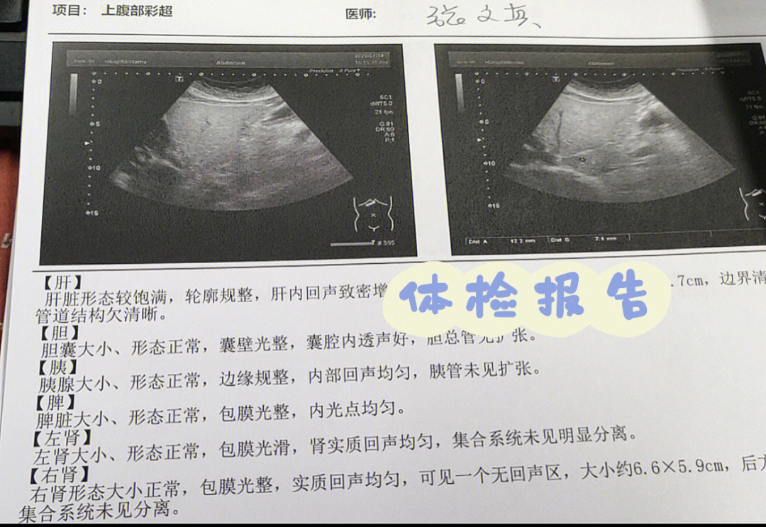 老妈肾囊肿的半个月历程01