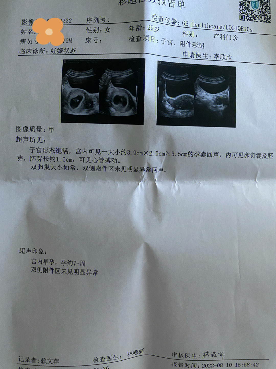 怀孕7周彩超图片