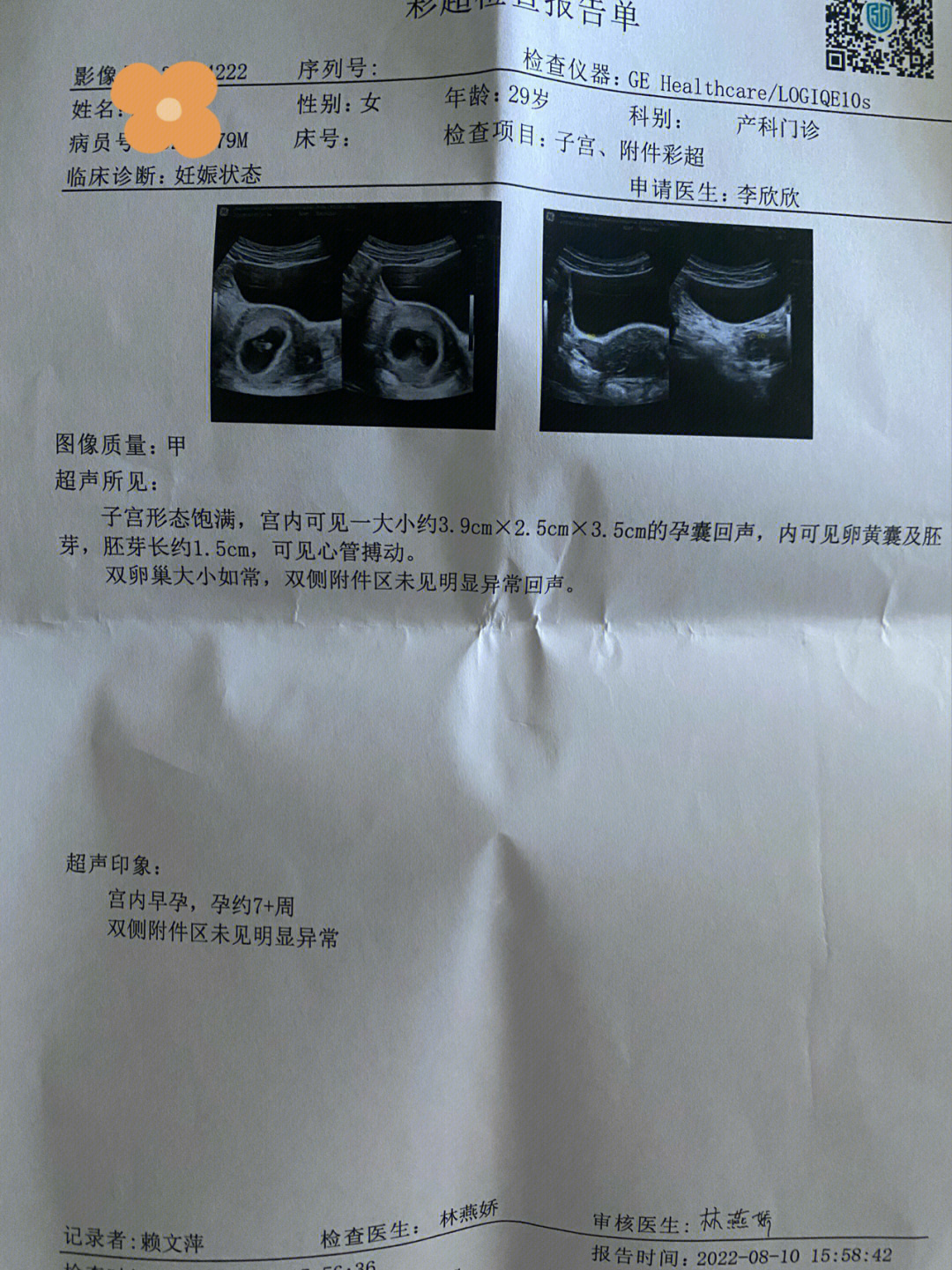 孕七周b超一切正常