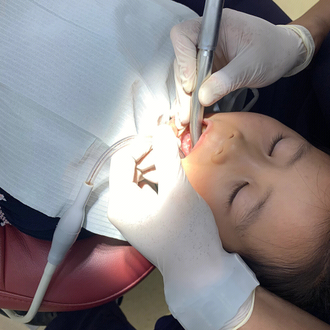 5岁的宝宝牙齿全部坏完了要治疗嘛?求经验